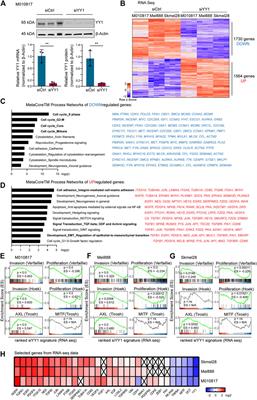 Loss of YY1, a Regulator of Metabolism in Melanoma, Drives Melanoma Cell Invasiveness and Metastasis Formation